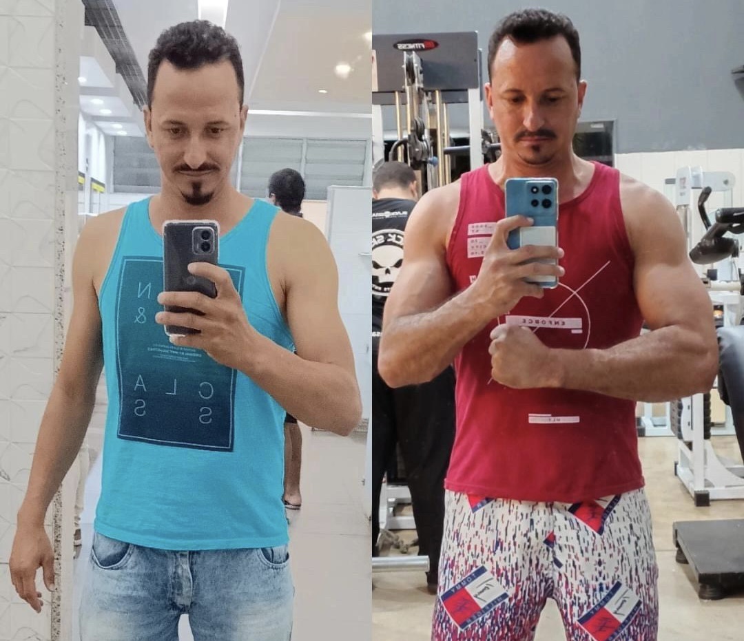 Antes e depois — depoimento 2