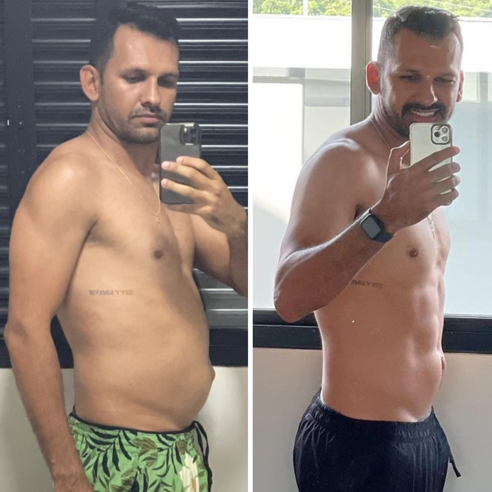 Antes e depois — depoimento 3